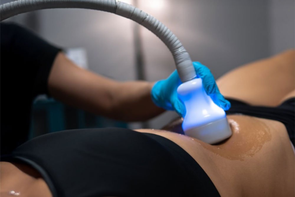 Exo Skin Cryo Body Contouring in University Total Wellness