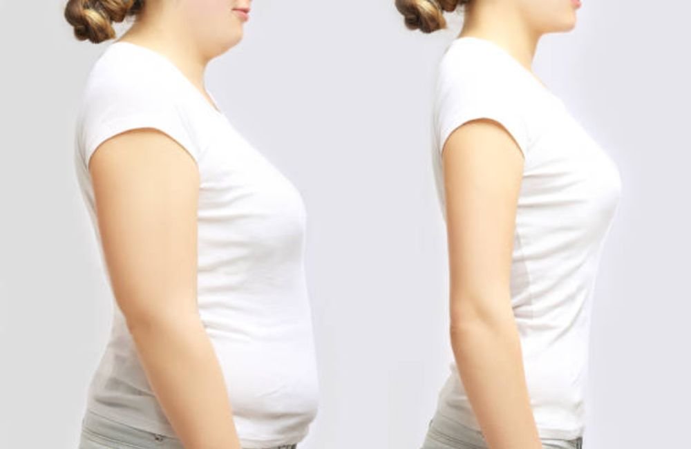 GLP‑1 Weight Loss Consulting in University Total Wellness