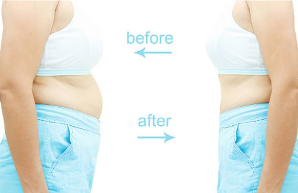 GLP‑1 Weight Loss Consulting in University Total Wellness